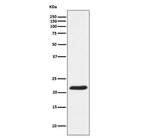 TCTP Recombinant Antibody / TPT1 - image 1