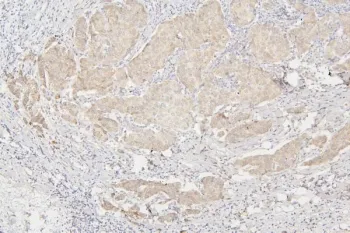 Semaphorin 3B Antibody / SEMA3B - image 1