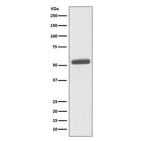 Pyruvate Kinase Recombinant Antibody / PKM2 - image 1