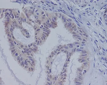 BRAF Recombinant Antibody - image 1