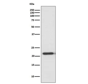TIMP2 Recombinant Antibody - image 1
