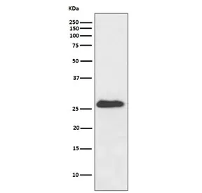 NQO2 Recombinant Antibody - image 1