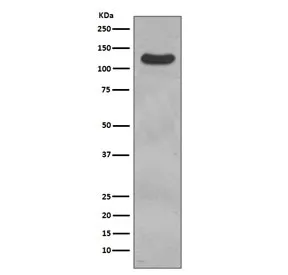 CD31 Recombinant Antibody / PECAM1 - image 1