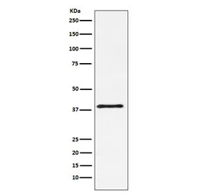 CTLA-4 Recombinant Antibody / CD152 - image 1
