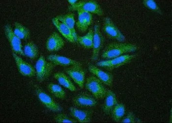 HSP27 Antibody / HSPB1 - image 1