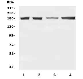 DCC Antibody / Deleted in Colorectal Carcinoma - image 1