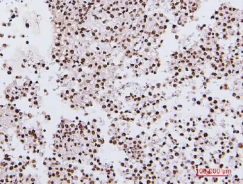 NRF1 Antibody / Nuclear Respiratory Factor 1 - image 1