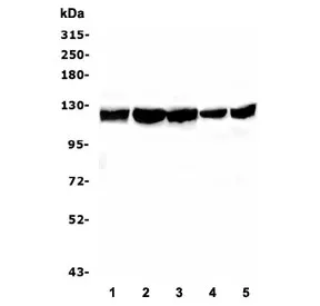 BUB1B Antibody / BubR1 - image 1