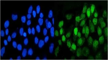 DDR1 Antibody - image 1