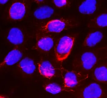 Beta Glucuronidase Antibody / Gusb - image 1