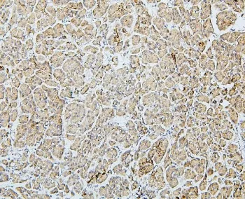 MTR Antibody / Methionine synthase - image 1