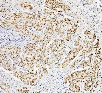 Histone H1.0 Antibody / H1F0 - image 1