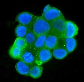 MPI Antibody / Mannose Phosphate Isomerase - image 1