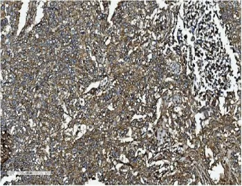 Clathrin Heavy Chain Antibody - image 1
