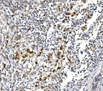 POLR2A Antibody / RNA polymerase II subunit RPB1 - image 1