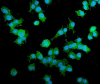 AKAP12 Antibody - image 1
