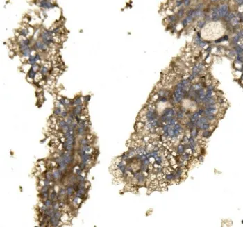 Arginase 2 Antibody - image 1