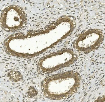 NRF-2 Antibody / NRF2L2 - image 1