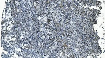 MCU Antibody / Calcium uniporter protein, mitochondrial - image 1