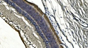 PDE6 alpha Antibody / PDE6A - image 1