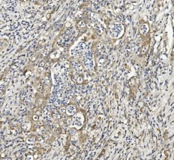 Semaphorin 6A Antibody / SEMA6A - image 1