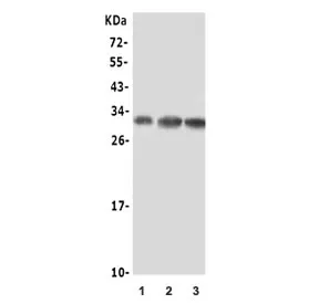 NGF Antibody / Beta NGF - image 1