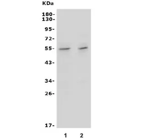Ifngr2 Antibody / IFN gamma Receptor beta - image 1