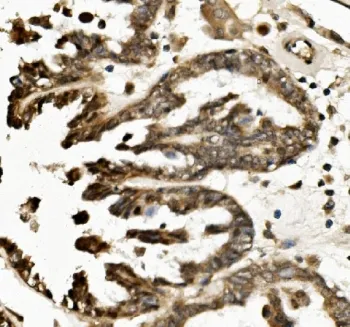 TXNIP Antibody - image 1