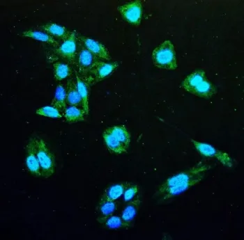 IDH1 Antibody / Isocitrate Dehydrogenase - image 1