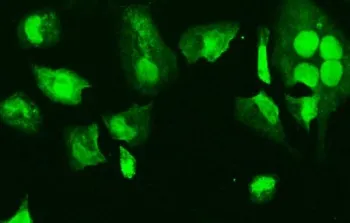 HMGB3 Antibody / HMG4 - image 1