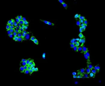 MC4R Antibody / MC4-R / Melanocortin Receptor 4 - image 1