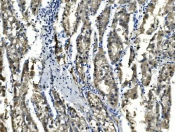 Sorbitol Dehydrogenase Antibody - image 1