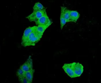 EEF2 Antibody / Elongation factor 2 - image 1