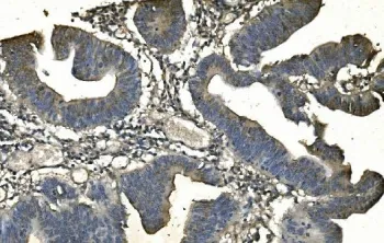 CD13 Antibody / ANPEP - image 1