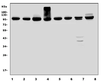 EEF2 Antibody / Elongation factor 2 - image 1