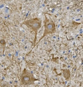 Neurofilament Antibody (-Light) / NF-L / NEFL - image 1