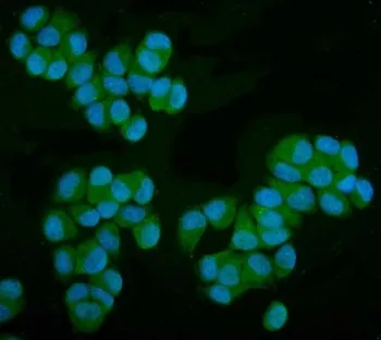 MPI Antibody / Mannose Phosphate Isomerase - image 1