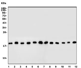 Inhibitor of DNA binding 2 Antibody / ID2 - image 1