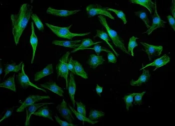 Irf3 Antibody / Interferon regulatory factor 3 - image 1