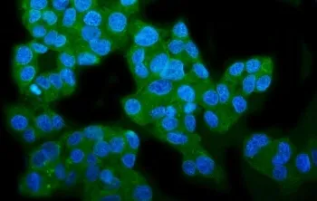 Wolframin Antibody / WFS1 - image 1