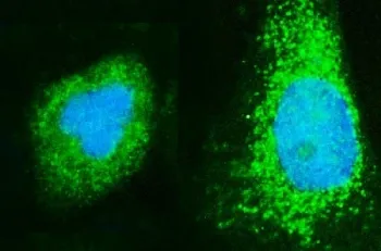 ADP-ribosylation factor 6 Antibody / ARF6 - image 1