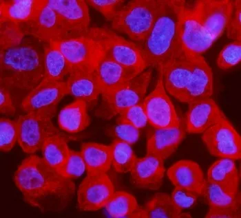 Interferon regulatory factor 3 Antibody / IRF3 - image 1