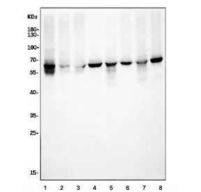 Elongator complex protein 3 Antibody / ELP3 / KAT9 - image 1
