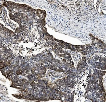 Proteasome subunit beta type-5 Antibody / PSMB5 / MB1 - image 1