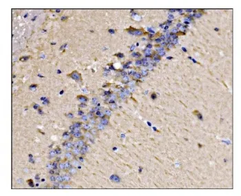 Dynamin 3 Antibody / DNM3 - image 1