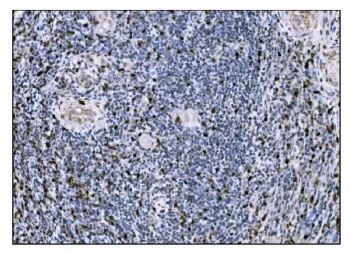 FosB Antibody - image 1