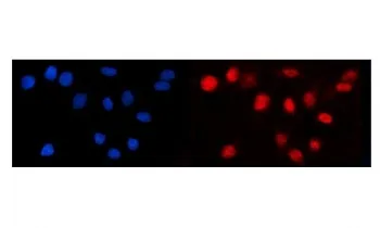 LEF1 Antibody / Lymphoid enhancer-binding factor 1 / TCF1 alpha - image 1