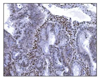 SRF Antibody / Serum Response Factor - image 1