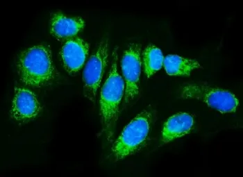 TRAP alpha Antibody / TRAPA / SSR1 - image 1