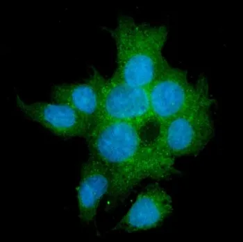 TGFBR2 Antibody / TGF beta Receptor II - image 1